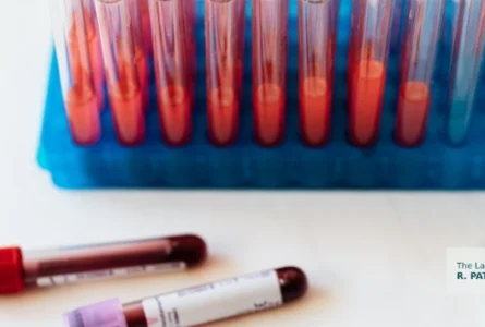 How Long Do DUI Blood Test Results Take in Hawaii?